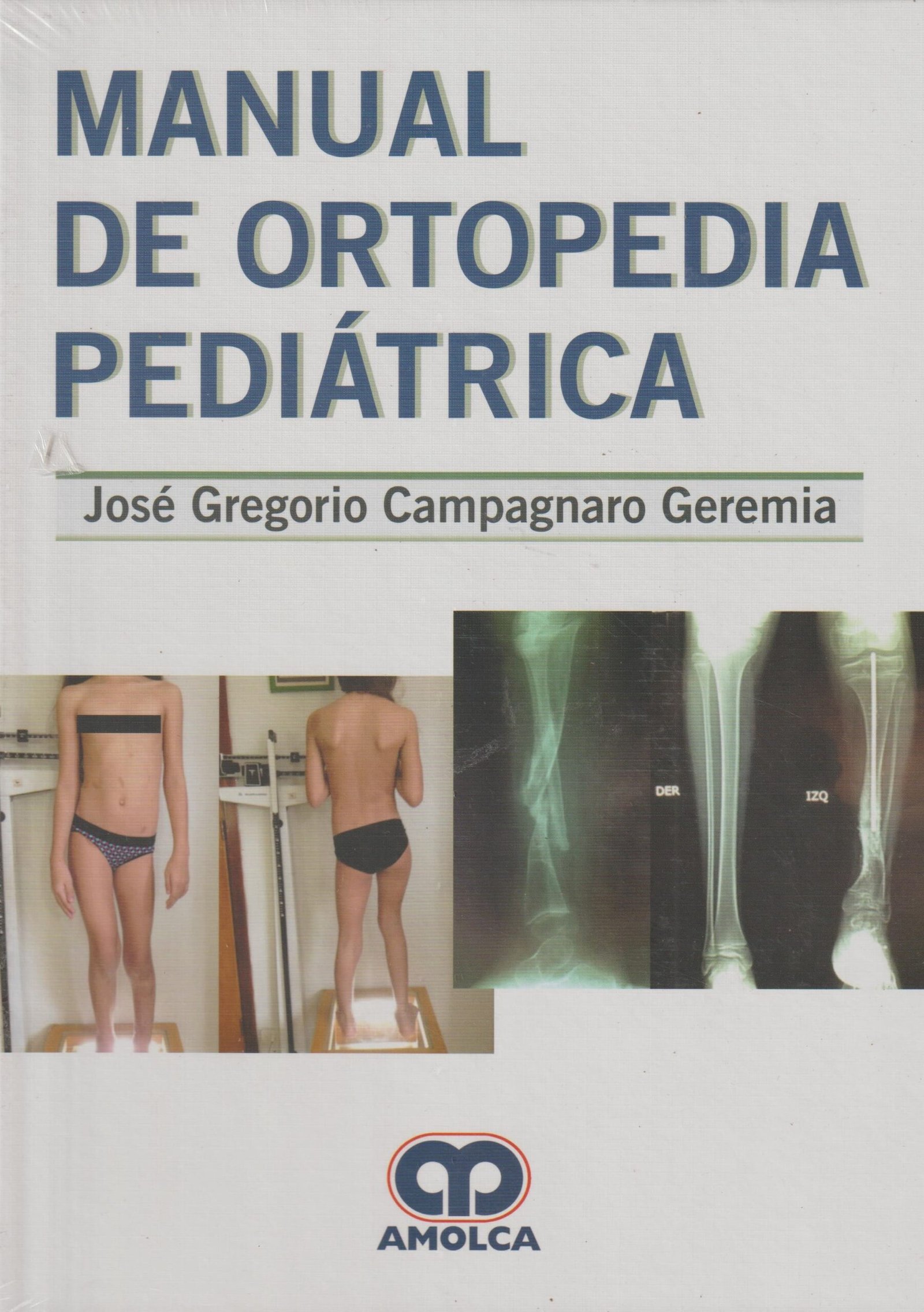MANUAL DE ORTOPEDIA PEDIATRICA - CAMPAGNARO