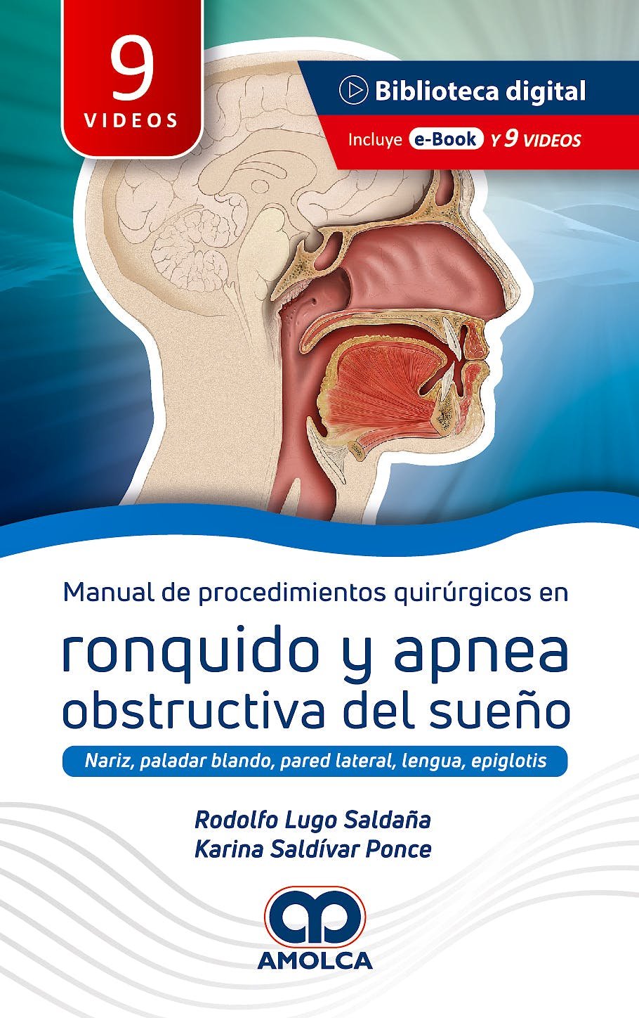 MANUAL DE PROCEDIMIENTOS QUIRURGICOS EN RONQUIDO Y APNEA OBSTRUCTIVA DEL SUEÑO - LUGO
