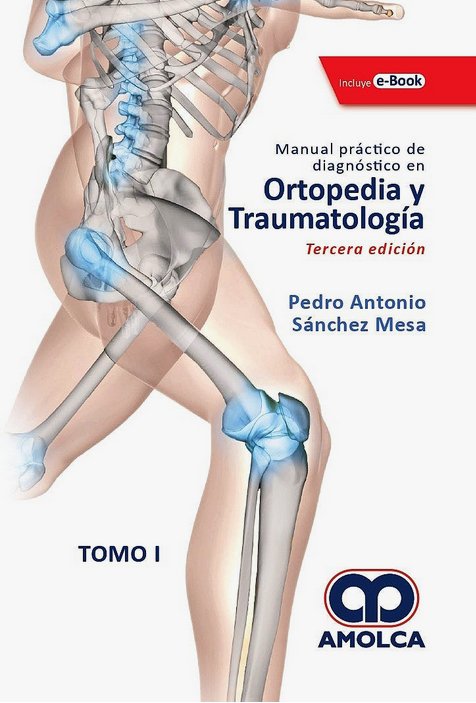 MANUAL PRACTICO DE DIAGNOSTICO EN ORTOPEDIA Y TRAUMATOLOGIA 3ED TOMO 1 - SANCHEZ MESA