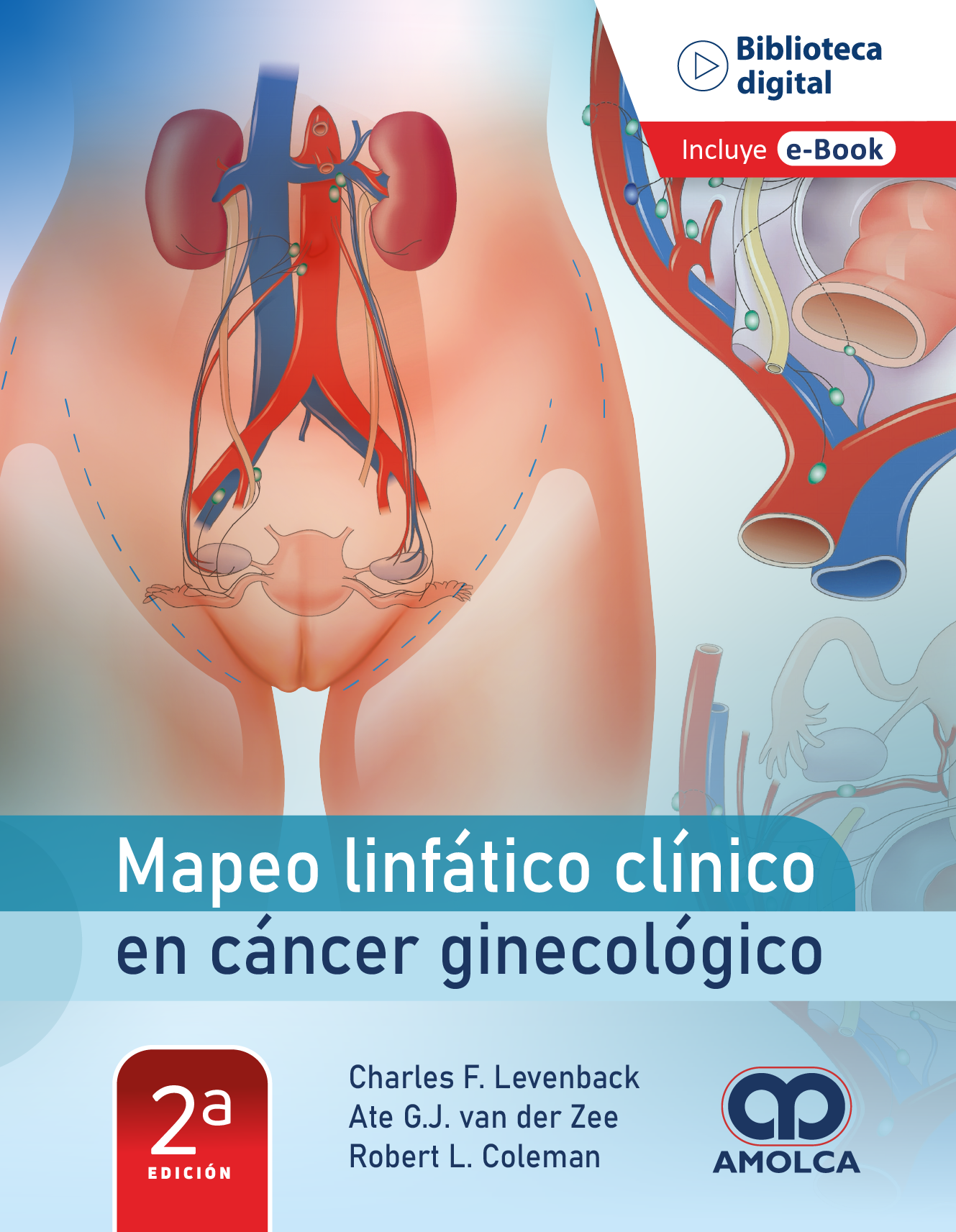 MAPEO LINFATICO CLINICO EN CANCER GINECOLOGICO 2ED - LEVENBACK