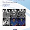 METASTASIS CEREBRALES NEUROIMAGEN AVANZADA - DOLGUSHIN
