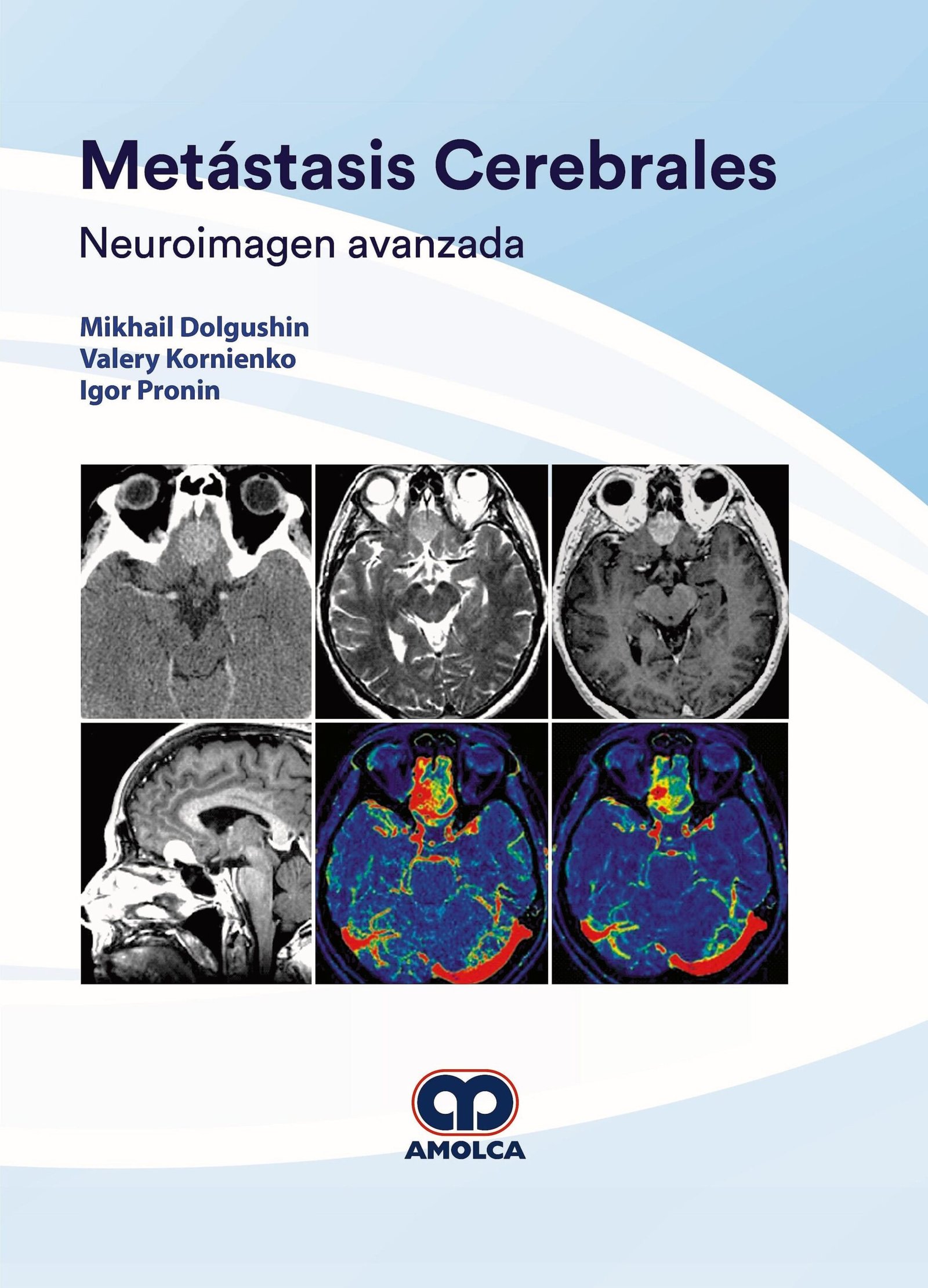 METASTASIS CEREBRALES NEUROIMAGEN AVANZADA - DOLGUSHIN