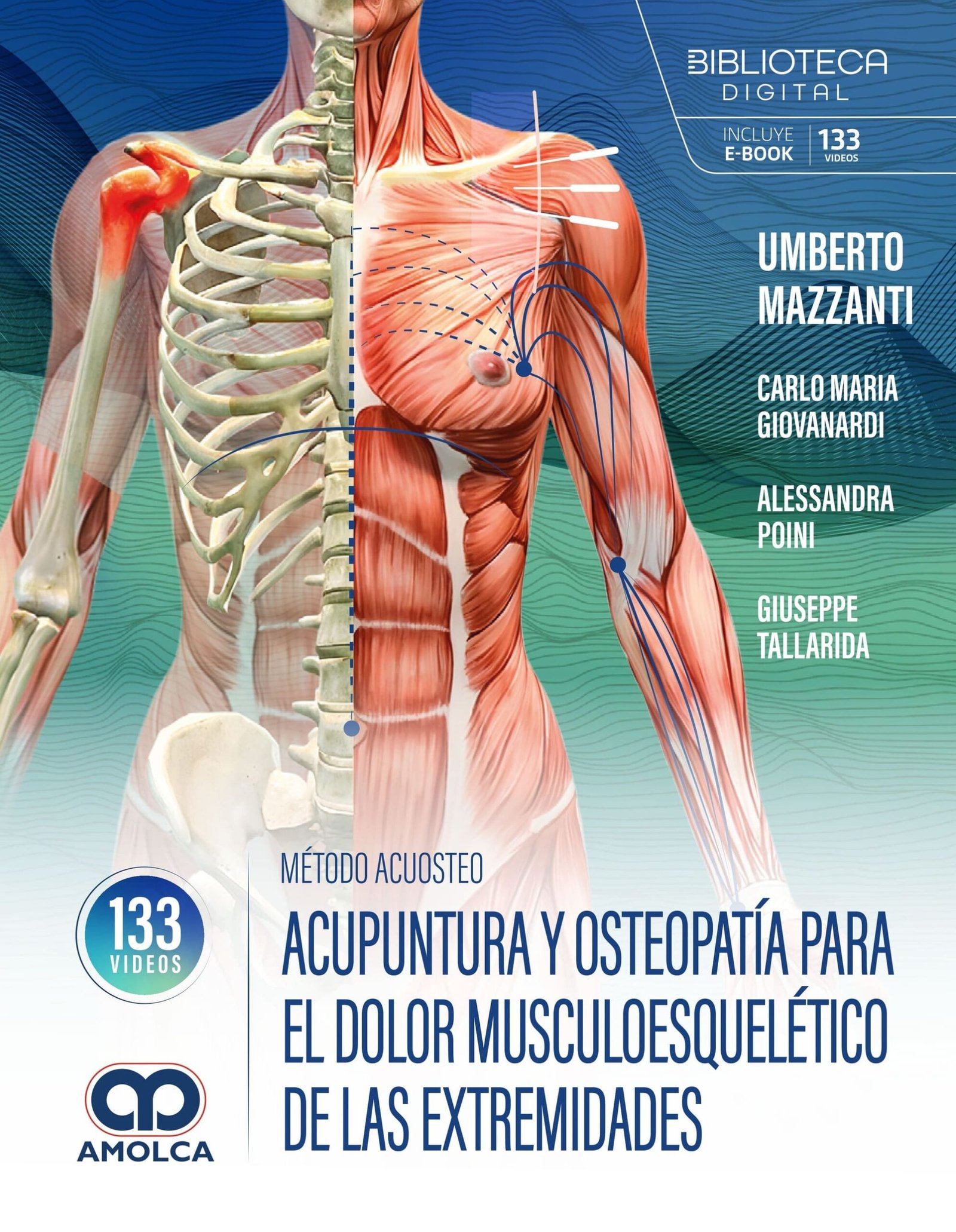 METODO ACUOSTEO ACUPUNTURA Y OSTEOPATIA PARA EL DOLOR MUSCULOESQUELETICO DE LAS EXTREMIDADES - MAZZANTI