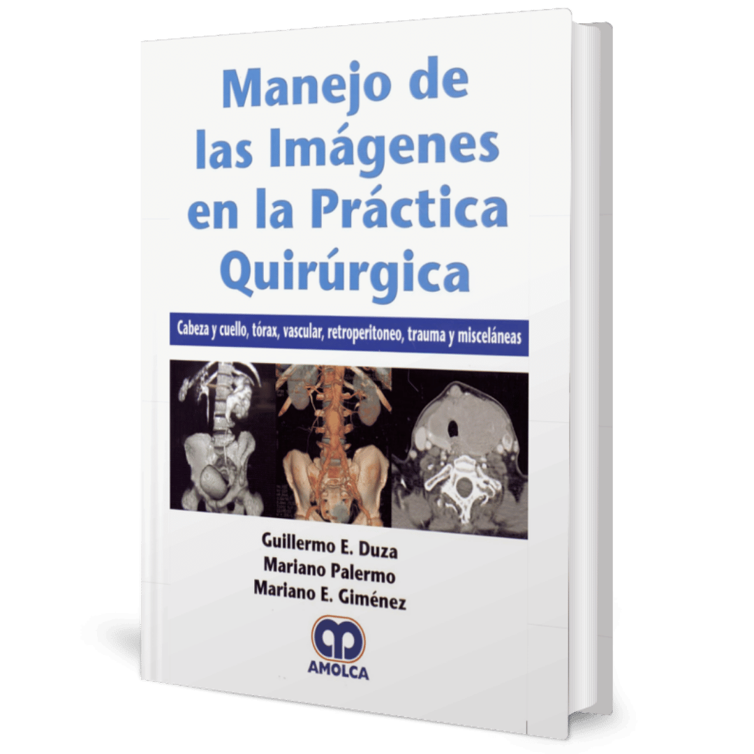 Manejo de las imagenes en la practica quirurgica cabeza y cuello torax vascular retroperitoneo trauma y miscelaneas Duza