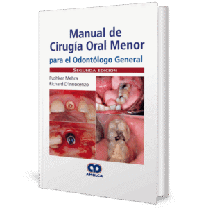 MANUAL DE CIRUGIA ORAL MENOR PARA EL ODONTOLOGO GENERAL 2ED