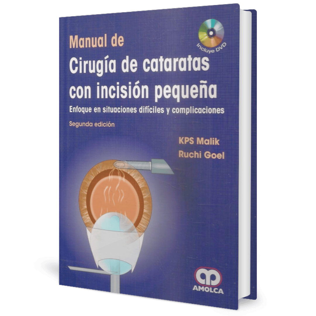 Manual de Cirugia de Cataratas Malik
