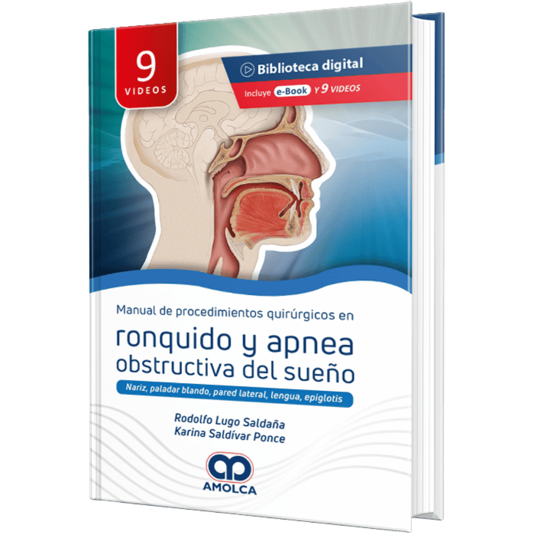 Manual de Procedimientos Quirurgicos en Ronquido y apnea obstructiva del sueño Lugo Saldaña