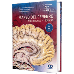 MAPEO DEL CEREBRO INDICACIONES Y TECNICAS
