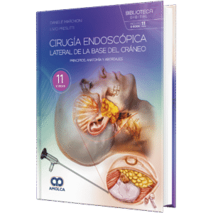 CIRUGIA ENDOSCOPICA LATERAL DE LA BASE DEL CRANEO PRINCIPIOS, ANATOMIA Y ABORDAJES