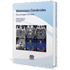 Metastasis Cerebrales Neuroimagen avanzada Dolgushin