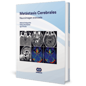 METASTASIS CEREBRALES NEUROIMAGEN AVANZADA