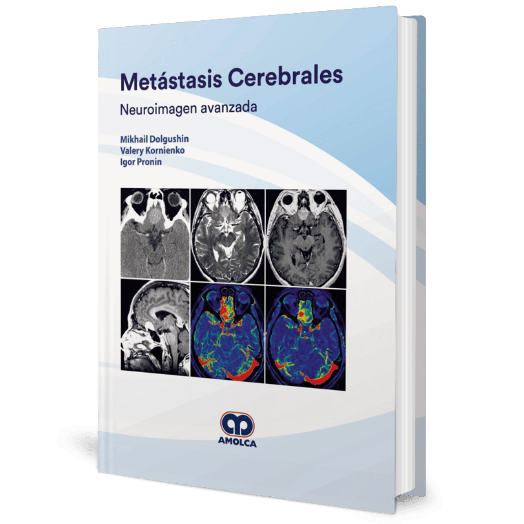Metastasis Cerebrales Neuroimagen avanzada Dolgushin