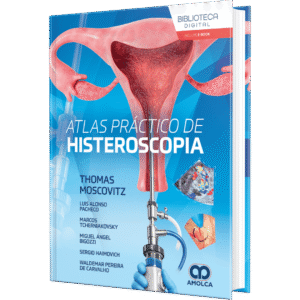 ATLAS PRACTICO DE HISTEROSCOPIA