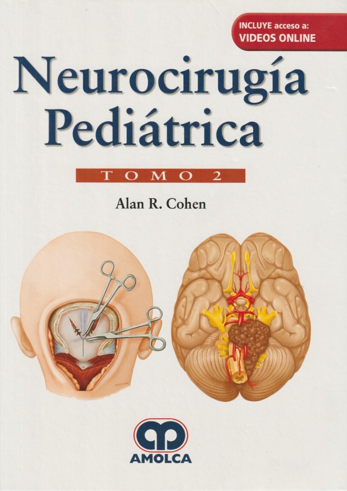 NEUROCIRUGIA PEDIATRICA (2 TOMOS) - Imagen 2