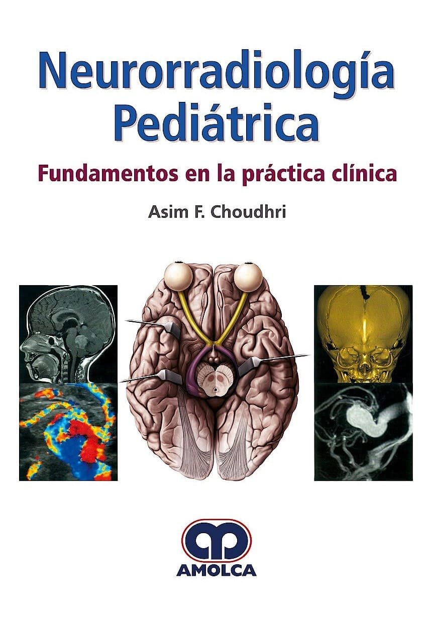 NEURORRADIOLOGIA PEDIATRICA FUNDAMENTOS EN LA PRACTICA CLINICA - CHOUDHRI