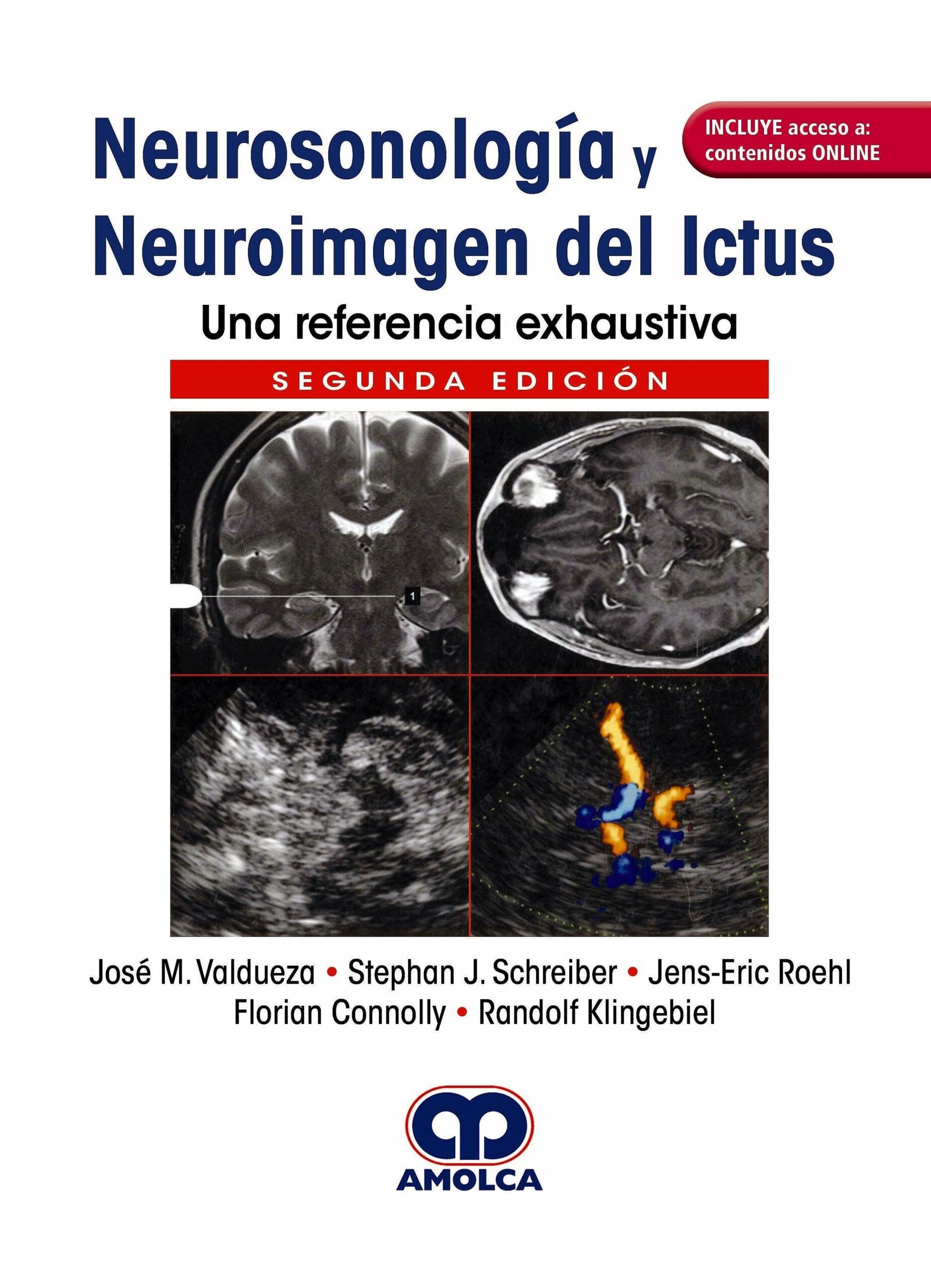 NEUROSONOLOGIA Y NEUROIMAGEN DEL ICTUS UNA REFERENCIA ESHAUSTIVA 2ED - VALDUEZA