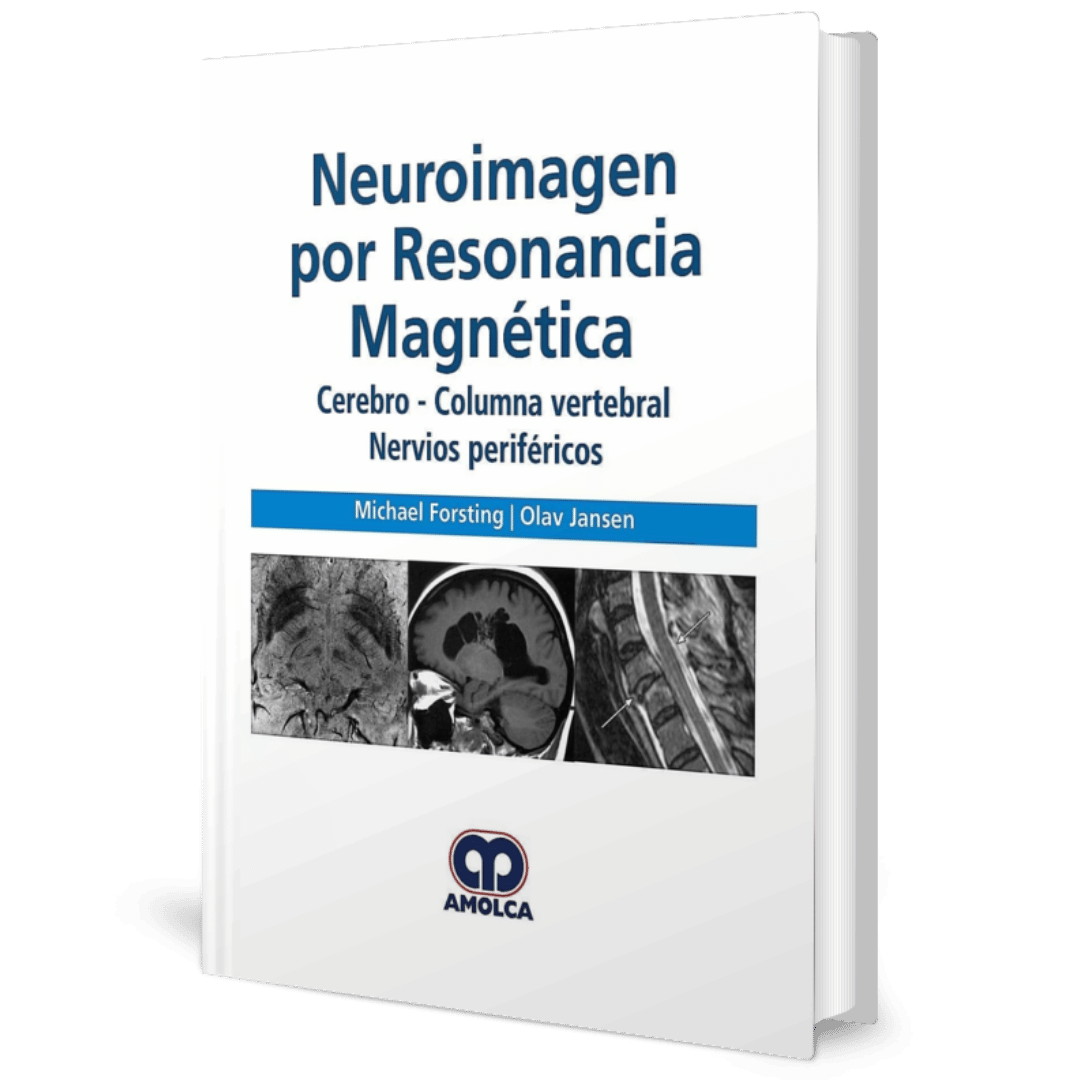 Neuroimagen por Resonancia Magnetica Cerebro Columna Vertebral Nervios Perifericos Forsting