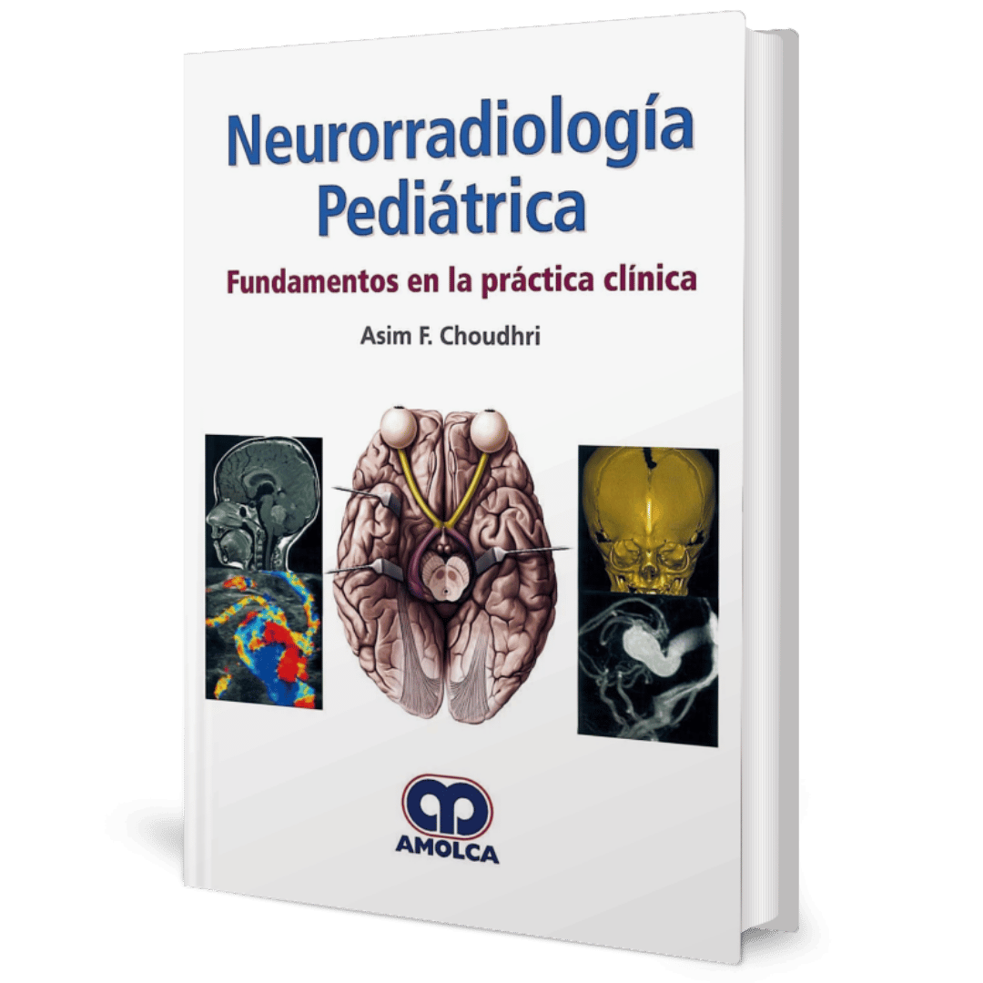 Neurorradiologia Pediatrica Fundamentos en la practica clinica Choudhri
