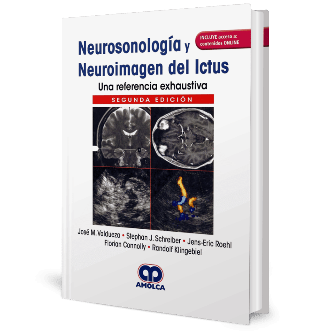 Neurosonologia y Neuroimagen del Ictus una referencia exhaustiva 2ed Valdueza