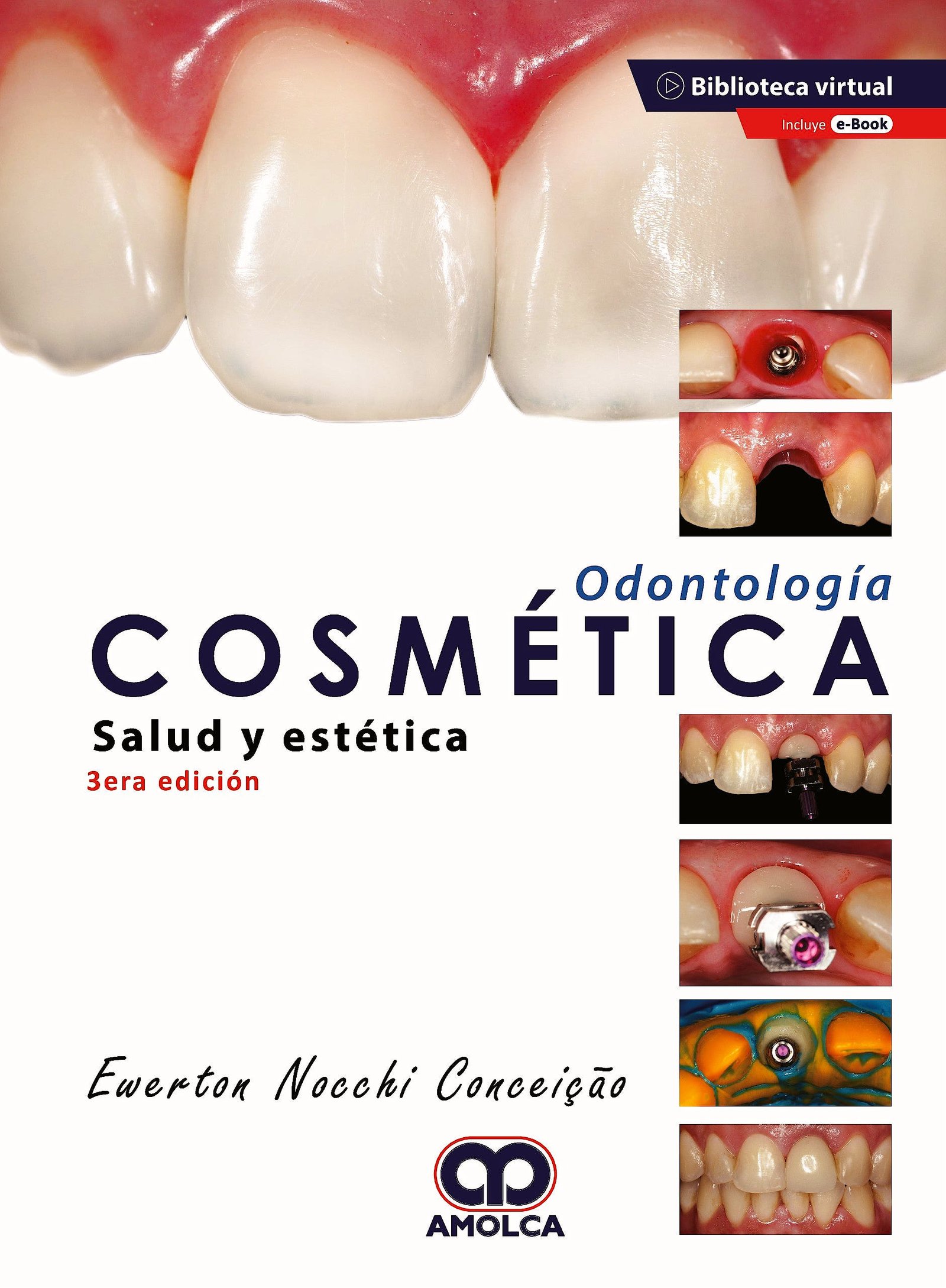 ODONTOLOGIA COSMETICA SALUD Y ESTETICA 3ED - NOCCHI
