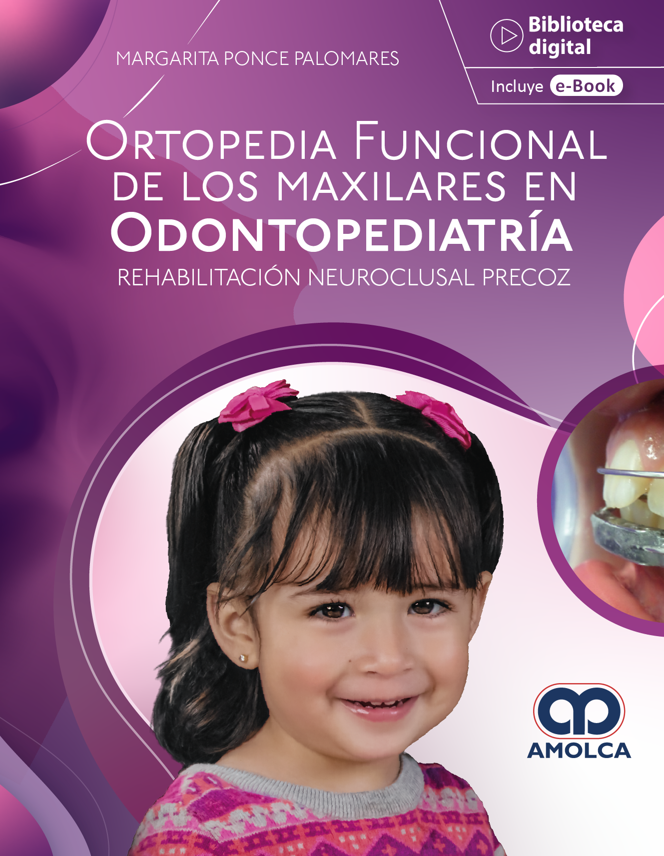 ORTOPEDIA FUNCIONAL DE LOS MAXILARES EN ODONTOPEDIATRIA REHABILITACION NEUROCLUSAL PRECOZ 1ED - PONCE