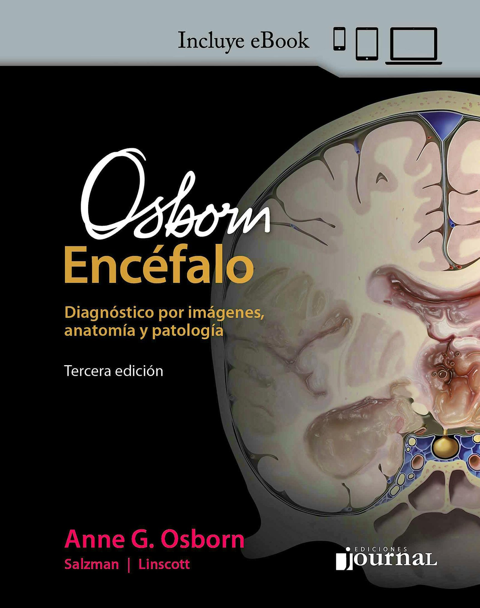 OSBORN ENCEFALO DIAGNOSTICO POR IMAGENES, ANATOMIA Y PATOLOGIA 3ED - OSBORN