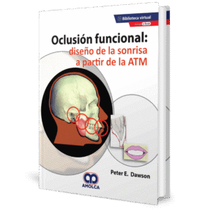 OCLUSION FUNCIONAL DISEÑO DE LA SONRISA A PARTIR DE LA ATM