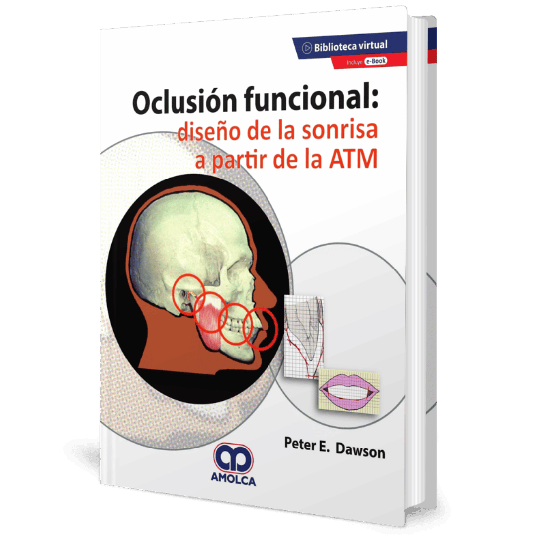 Oclusion funcional diseño de la sonrisa a partir de la ATM Dawson