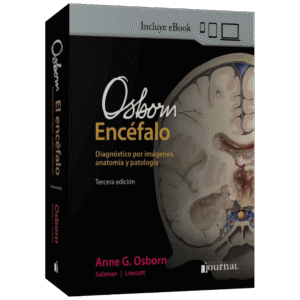 OSBORN ENCEFALO DIAGNOSTICO POR IMAGENES, ANATOMIA Y PATOLOGIA 3ED