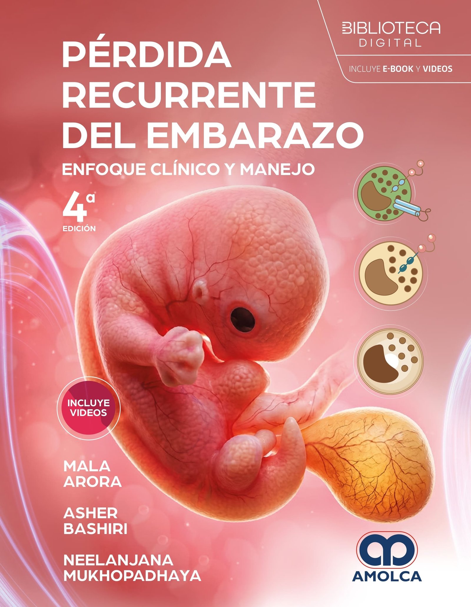 PERDIDA RECURRENTE DEL EMBARAZO ENFOQUE CLINICO Y MANEJO 4ED - Imagen 2