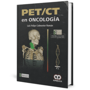PET/CT EN ONCOLOGIA