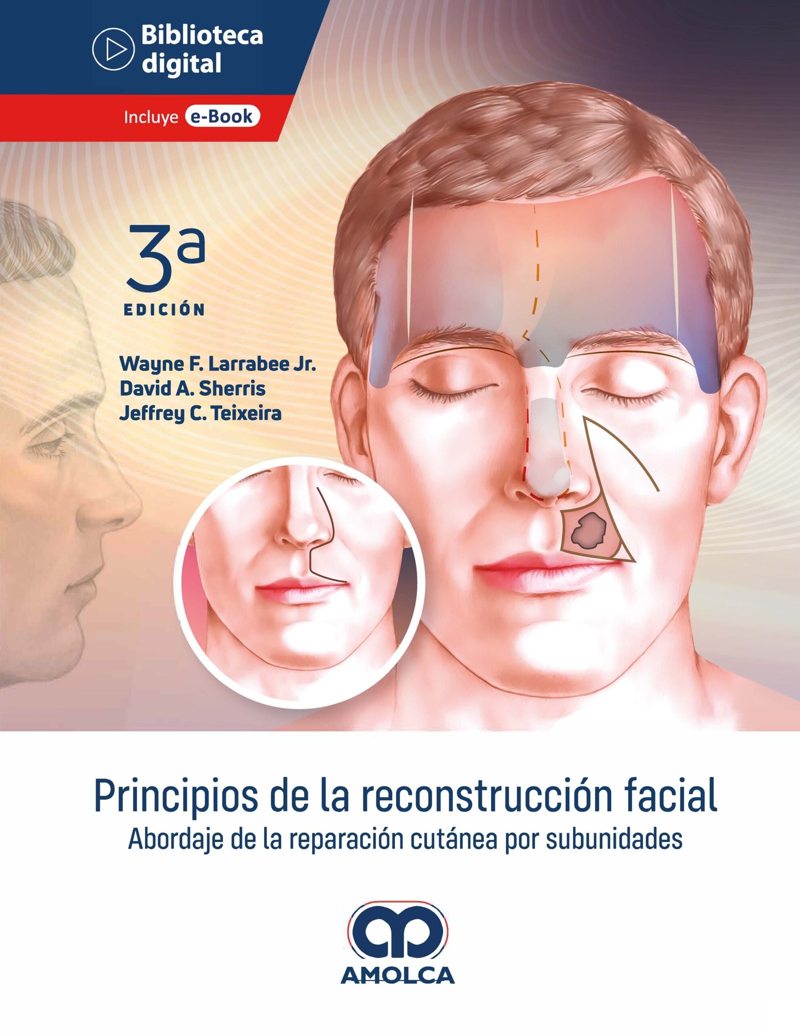 PRINCIPIOS DE LA RECONSTRUCCION FACIAL ABORDAJE DE LA REPARACION CUTANEA POR SUBUNIDADES - LARRABEE