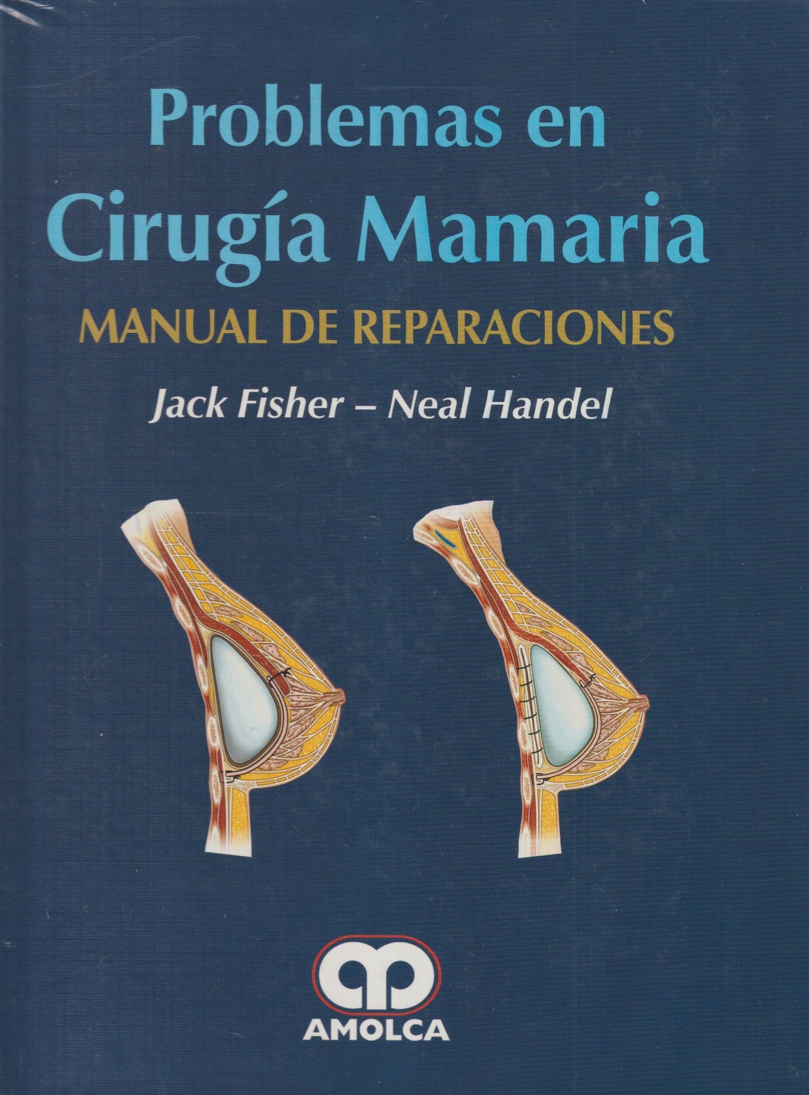 INTERPRETACION DE BIOPSIAS DE TUMORES DEL TEJIDO BLANDO 2ED - Imagen 2