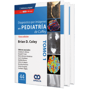 DIAGNOSTICO POR IMAGENES EN PEDIATRIA DE CAFFEY 13ED (2 TOMOS)