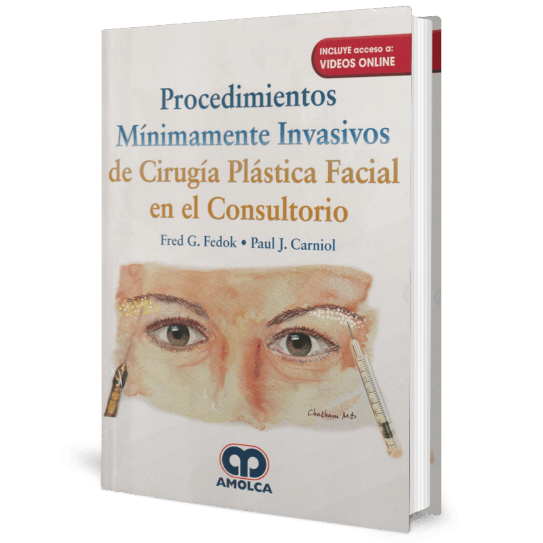 Procedimientos minimamente invasivos de cirugia plastica facial en el consultorio Fedok