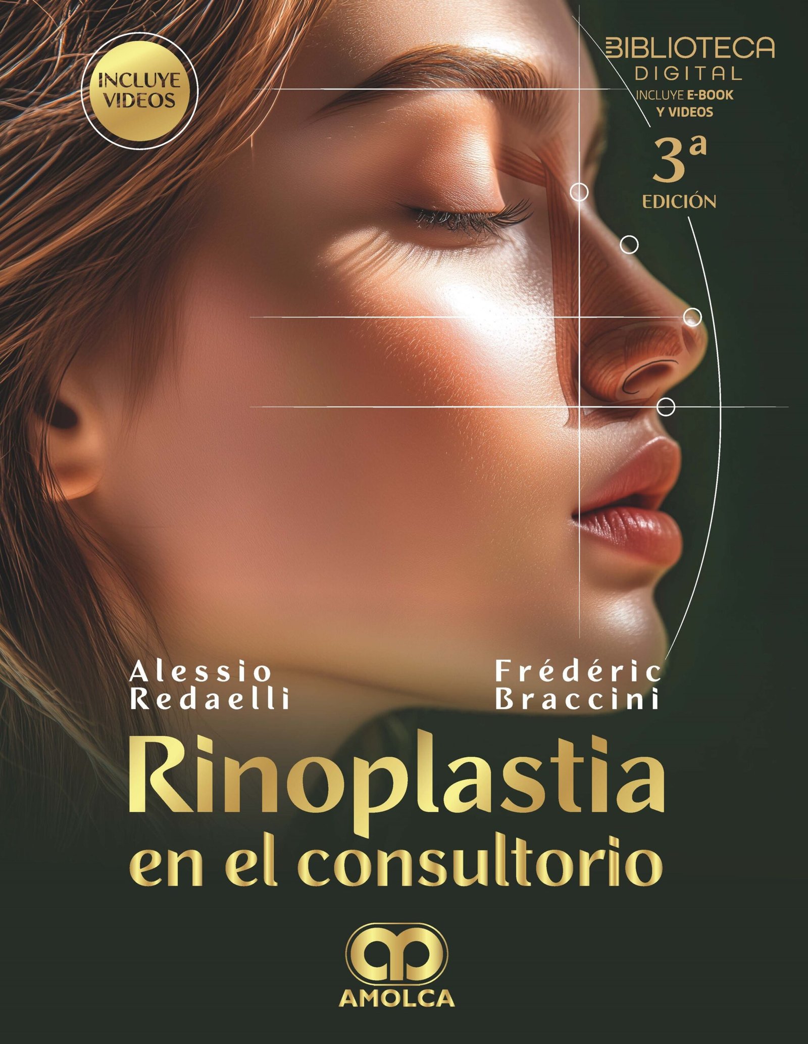 RINOPLASTIA EN EL CONSULTORIO 3ED - REDAELLI