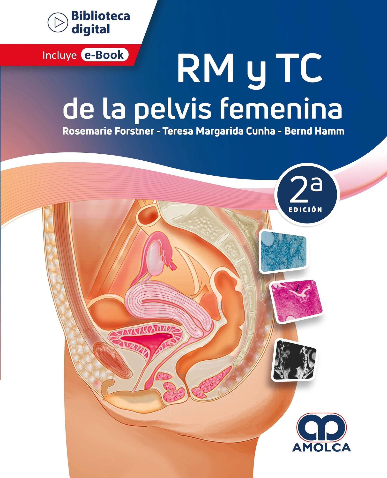RM Y TC DE LA PELVIS FEMENINA + EBOOK - FORSTNER