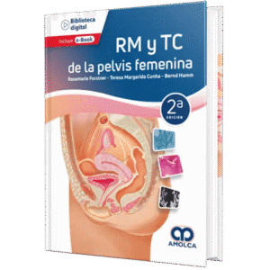 RM Y TC DE LA PELVIS FEMENINA