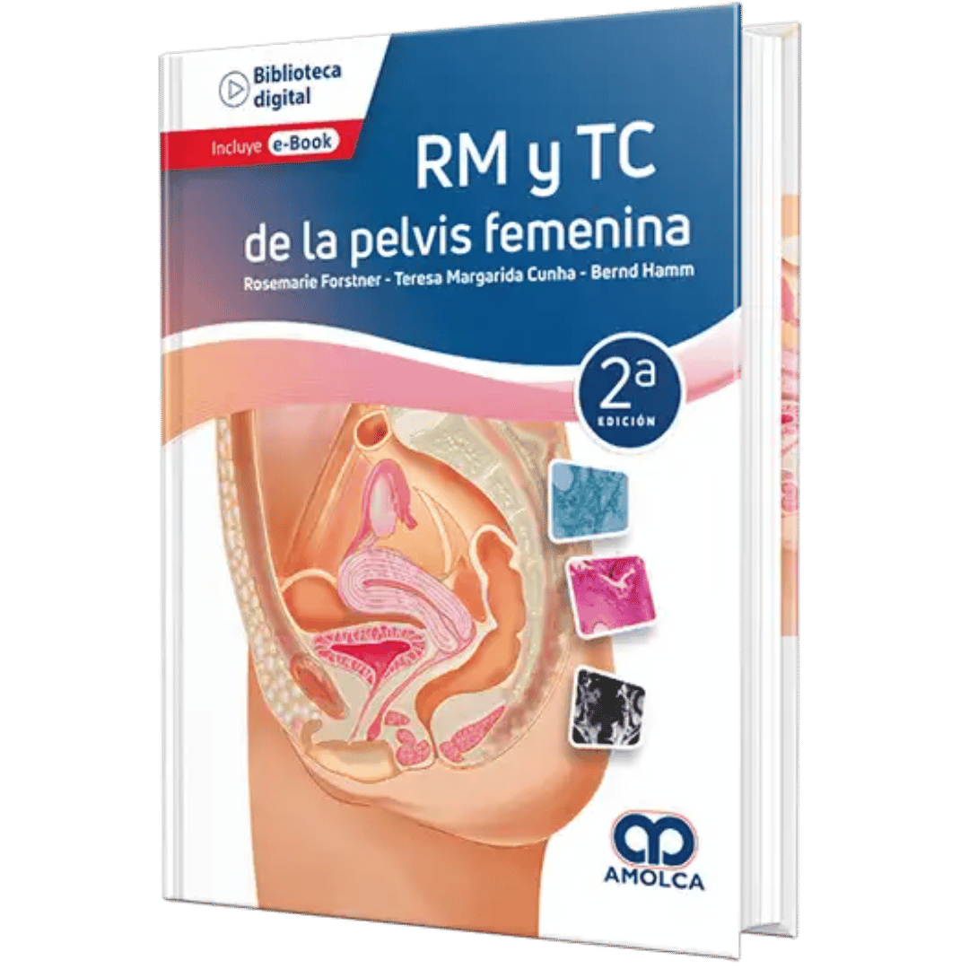 RM y TC de la Pelvis Femenina Forstner