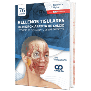 RELLENOS TISULARES DE HIDROXIAPATITA DE CALCIO