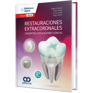 RESTAURACIONES EXTRACORONALES CONCEPTOS Y APLICACIONES CLINICAS