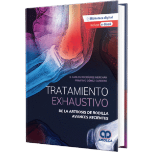 TRATAMIENTO EXHAUSTIVO DE LA ARTROSIS DE RODILLA AVANCES RECIENTES
