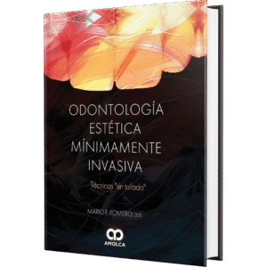 ODONTOLOGIA ESTETICA MINIMAMENTE INVASICA TECNICAS “SIN TALLADO”