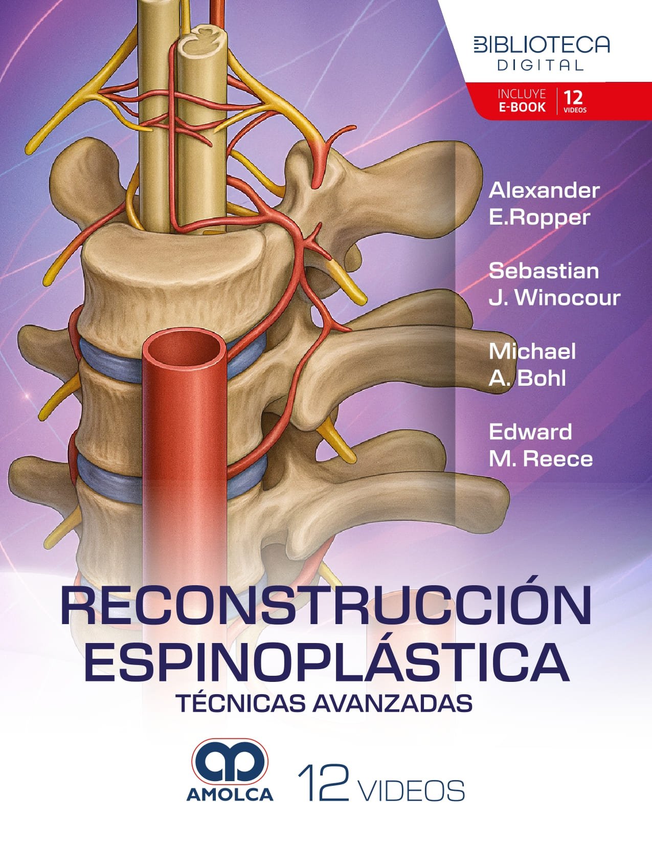 Ropper Cover-1