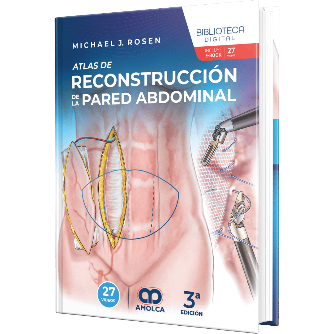 Rosen Reconstrucción