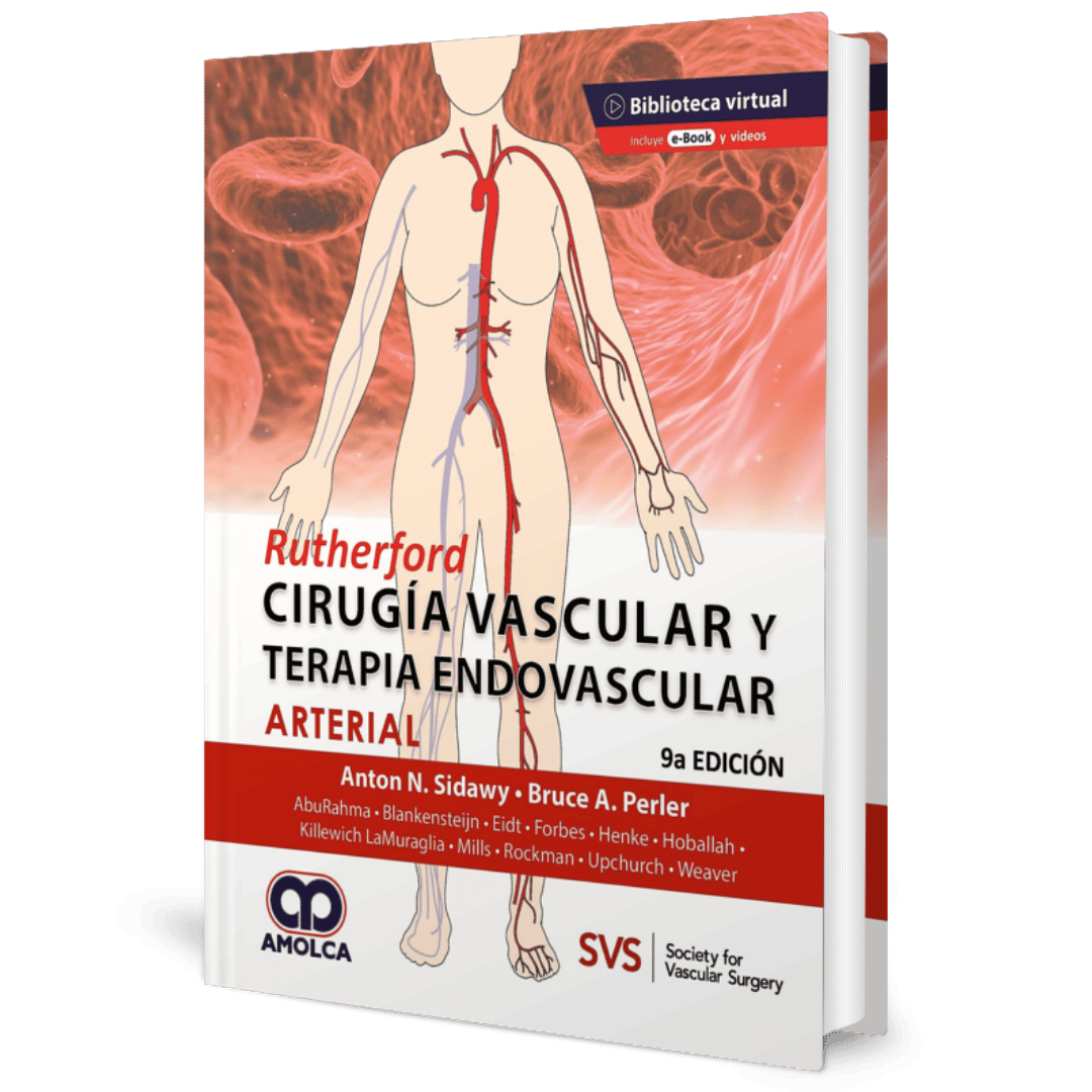 Rutherford Cirugia Vascular y Terapia Endovascular Arterial 9ed Sidway