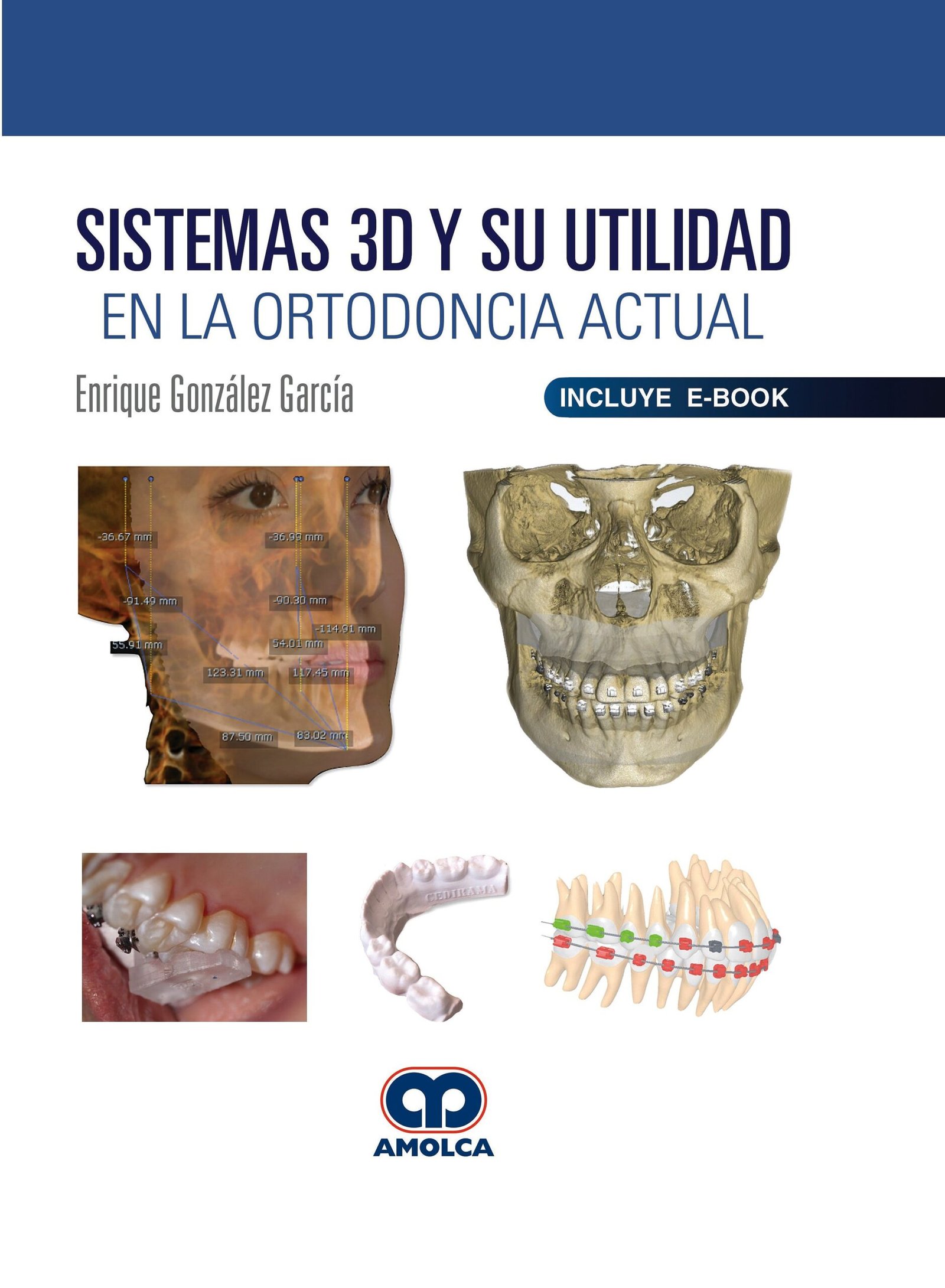 SISTEMAS 3D Y SU UTILIDAD EN LA ORTODONCIA ACTUAL - GONZALEZ