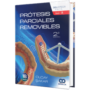 PROTESIS PARCIALES REMOVIBLES 2ED