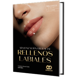 ARMONIZACION OROFACIAL RELLENOS LABIALES