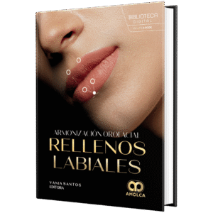 ARMONIZACION OROFACIAL RELLENOS LABIALES